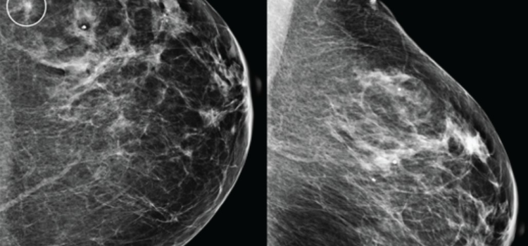 Breast Imaging | Imaging Technology News